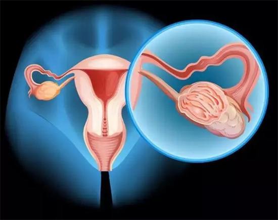 高龄女性怀上双胎有什么危险？高龄备孕如何调理卵巢功能