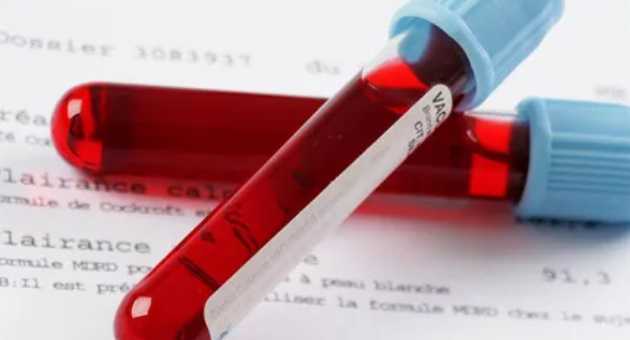 假性怀孕时hcg值会升高吗