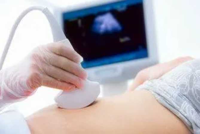 刚怀孕要做的检查，别太早去医院