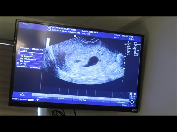 高龄孕妇怎么预防难产