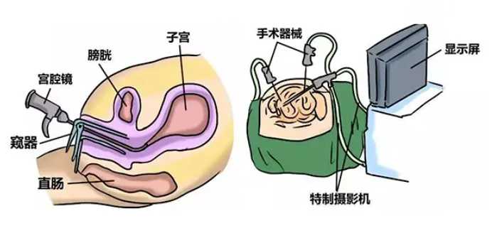 丽水做不了三代试管？别急，这些医院可以帮你