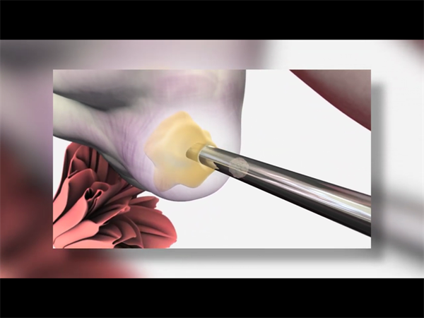 北京妇产医院生殖科哪些大夫人工授精做得好