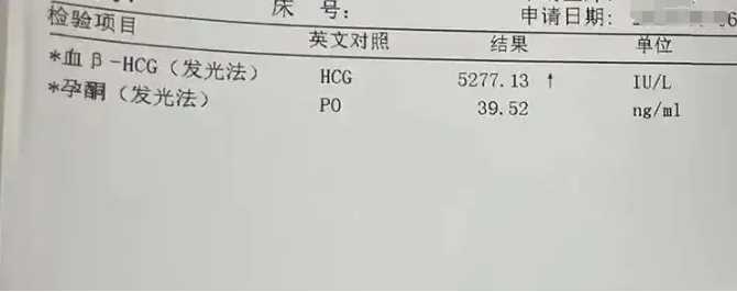 促排卵方案怎么选？哪种更适合你