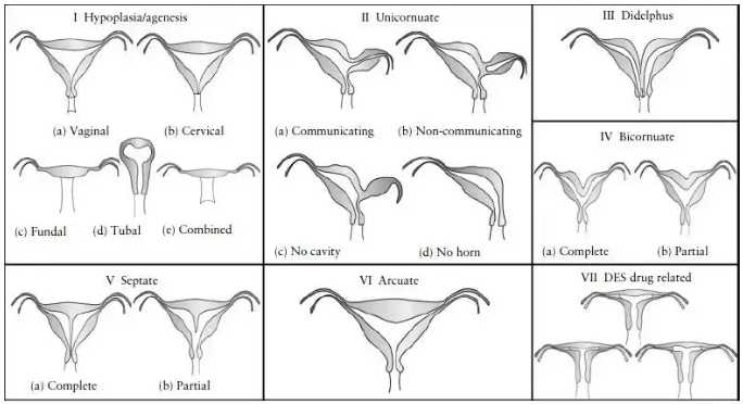 高龄女性做试管婴儿，先看看这五个条件