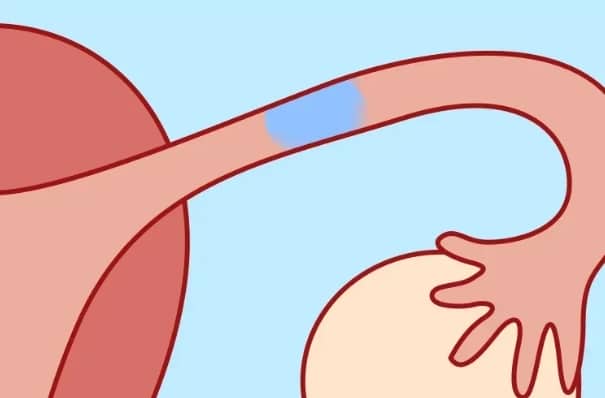 40岁做试管婴儿，行不行？我来给你讲讲流程