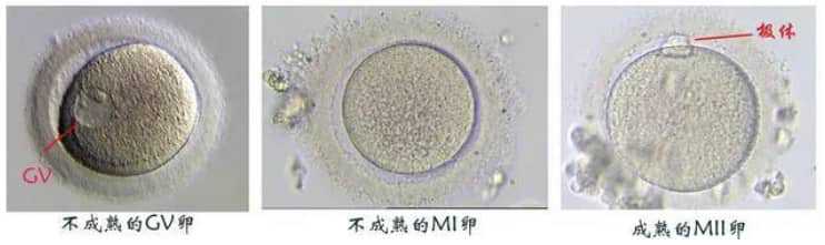 系统性红斑狼疮怎么诊断？看看这些标准