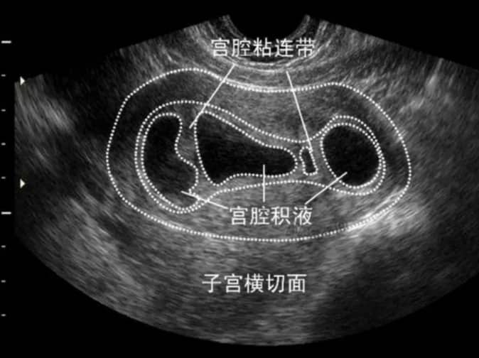 45岁男性做试管婴儿的成功率怎么样