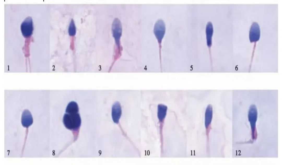 45岁选人工授精还是试管婴儿？听听过来人的建议