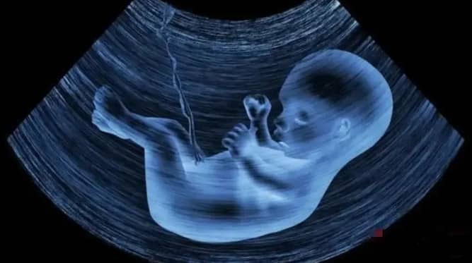 国内试管包生男孩的费用和注意事项