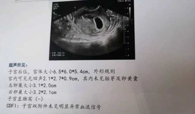 广州试管婴儿助孕流程，一步步带你了解