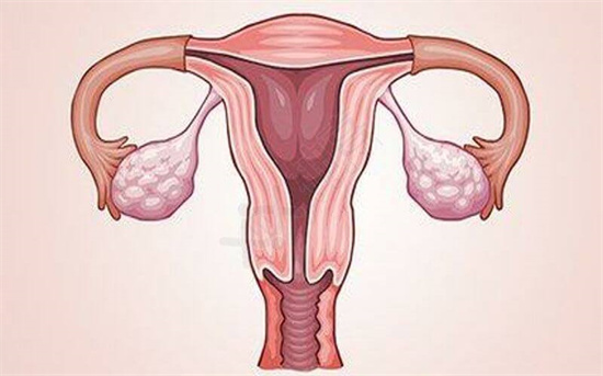 子宫纳氏囊肿是怎么回事？盘点子宫肌瘤的症状表现有哪些？