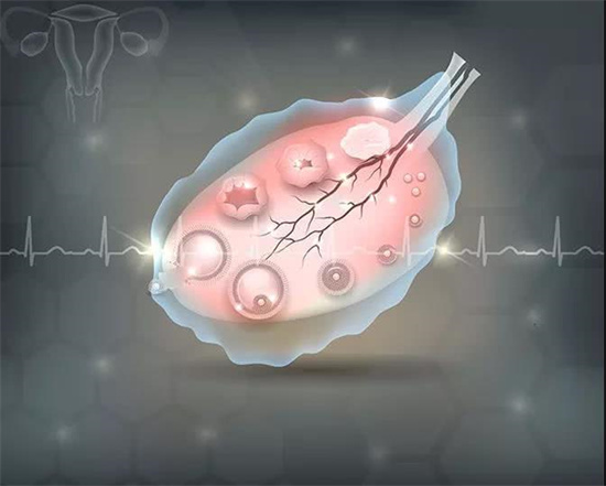 患有多囊卵巢综合征的女性还能正常怀孕吗 多囊卵巢综合征患者生育有哪些风险