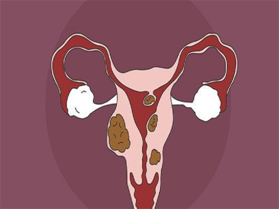 什么是功能性子宫出血？子宫出血怎么办？